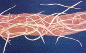 Parasitic Worms Parasitic Worms