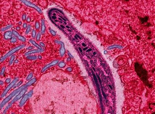 Climate change poses malaria risks Climate change poses malaria risks