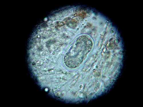 Capilliaria (hairworm) egg under the microscope - note thick outer wall making egg resistance to drying, cleaning and disinfestants