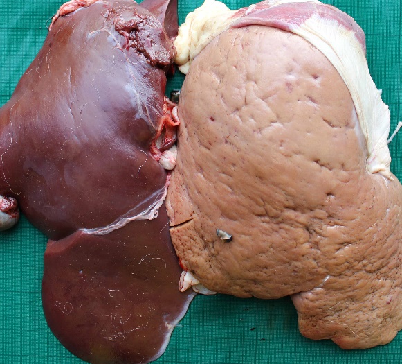 Normal liver