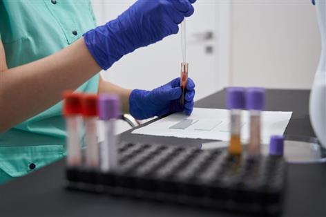 Free prostate cancer checks offered to farmers at NSA Sheep Event